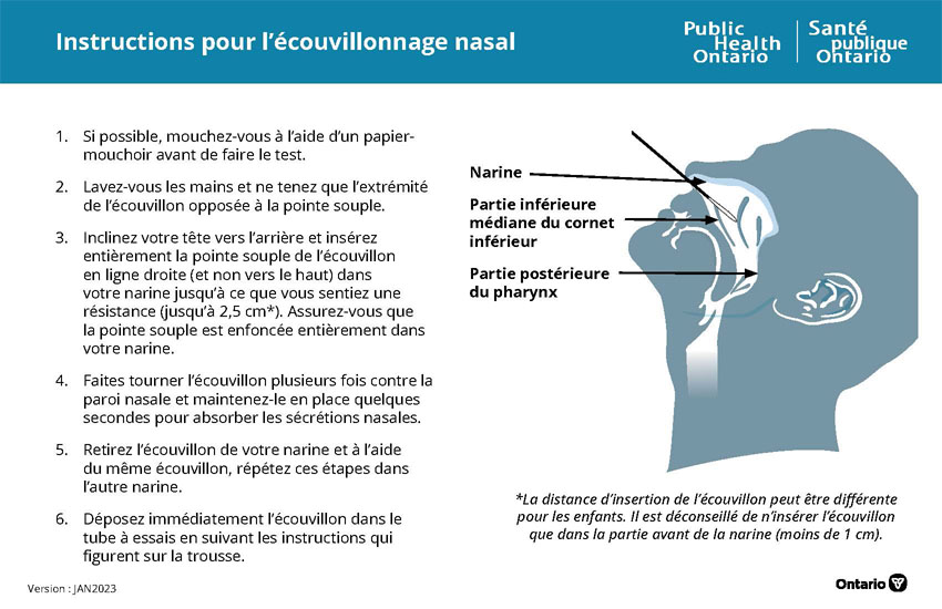 Instructions pour l’écouvillonnage nasal