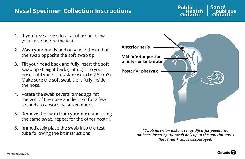 Nasal Specimen Collection Instructions
