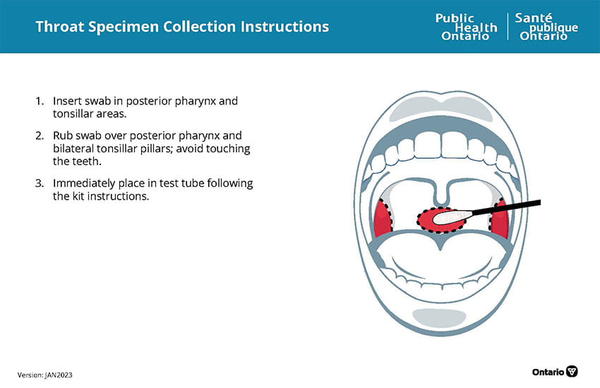 Throat Specimen Collection Instructions
