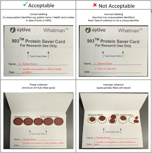 DBS collection labelling table
