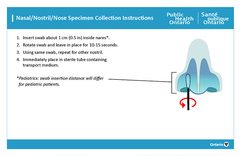 Photo of nasal/nostril/nose specimen collection