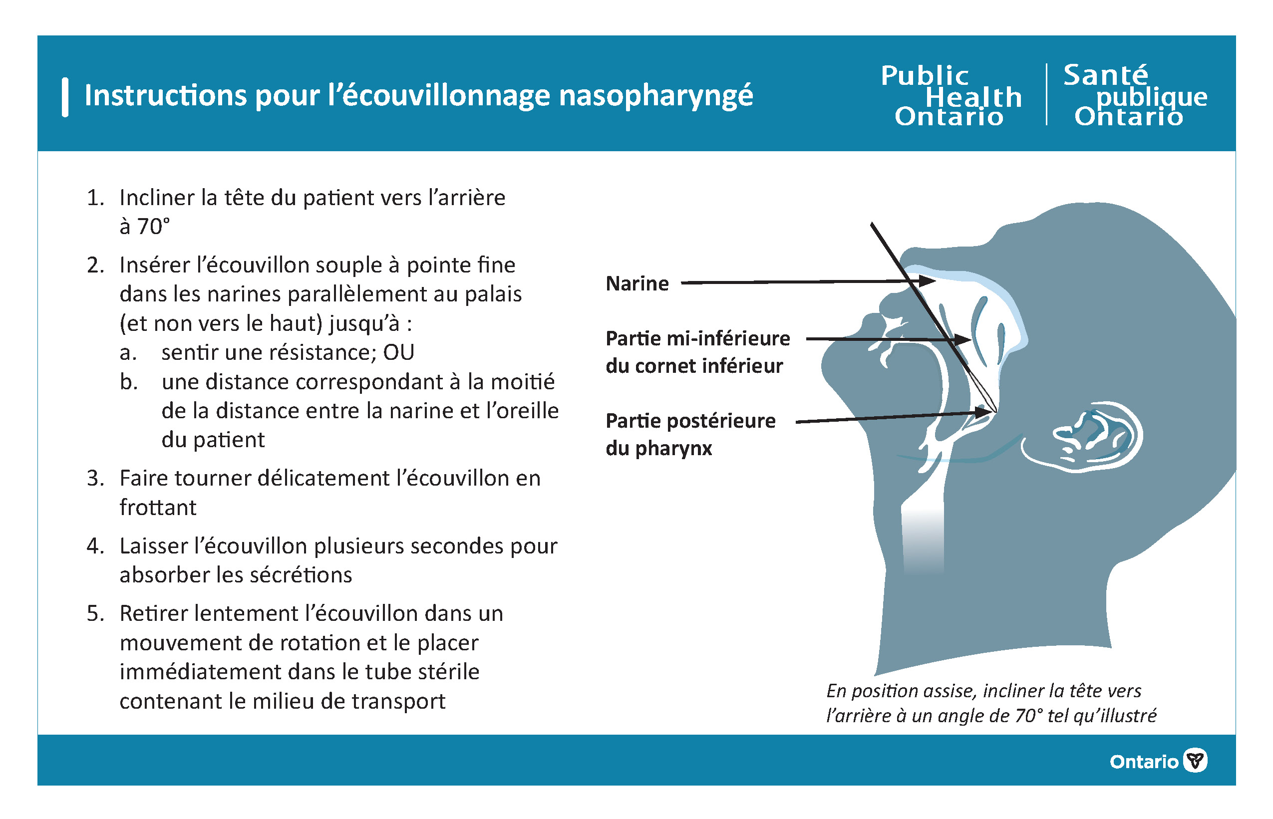 Instructions pour l’écouvillonnage nasopharyngé et la commande de