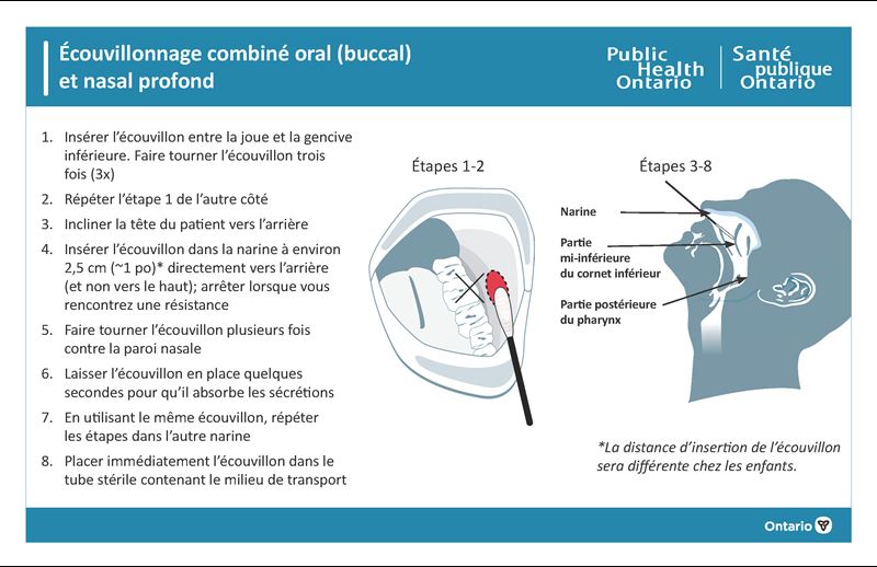 Photo des instructions pour oral (buccal) et nasal profond et la commande de trousses 