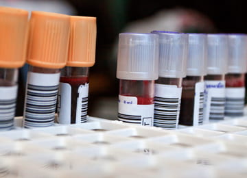 Image of blood collection tubes in the holder in the laboratory.