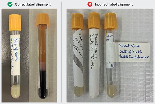 Serology Labels